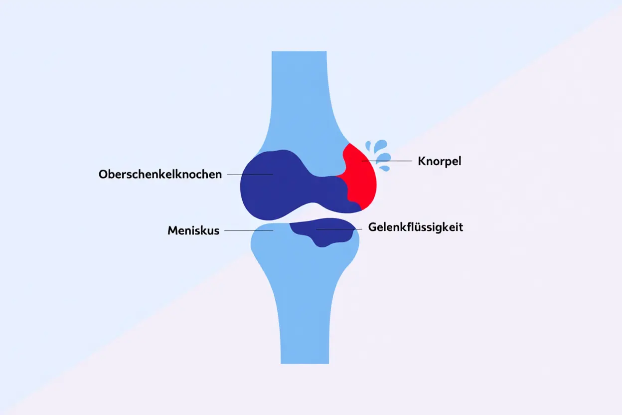 Anatomie des Kniegelenks